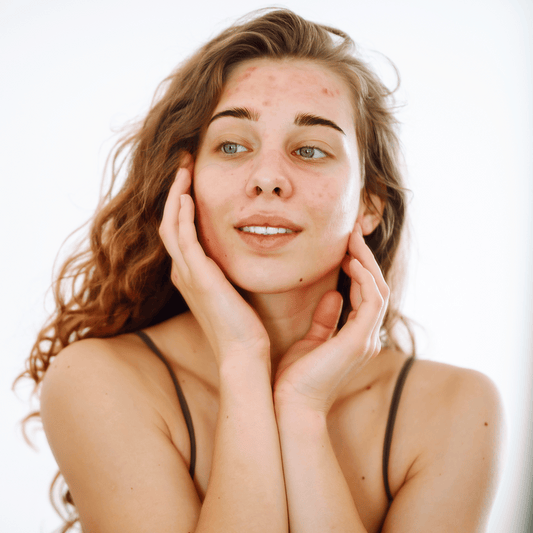 Vochttekort in de huid: oorzaken en oplossingen